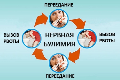 Лечение булимии в Мамонтово
